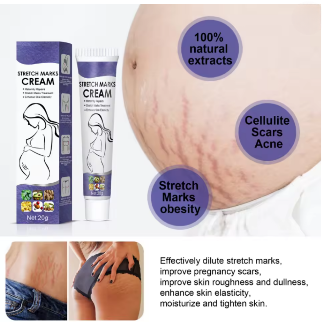 Stretch Mark Cream
